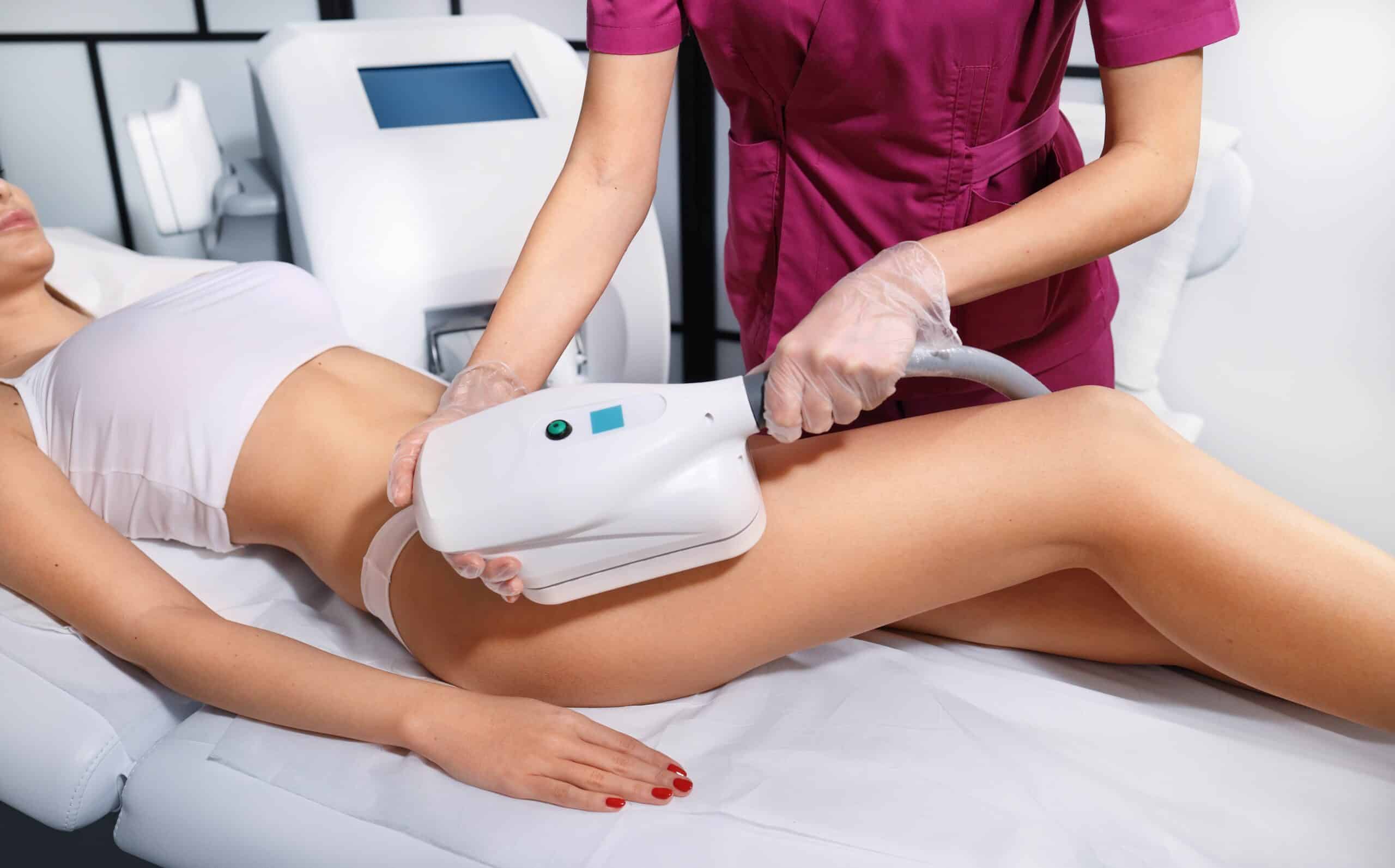Junge Frau erhält eine Kryolipolyse-Behandlung in einem Kosmetiksalon. Fettgefrieren-Technologie an den Beinen. Coolsculpting-Verfahren